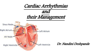 Cardiac Arrhythmias
and
their Management
Dr. Nandini Deshpande
 