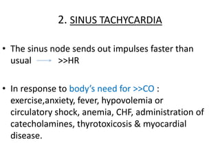 2. SINUS TACHYCARDIA
• The sinus node sends out impulses faster than
usual >>HR
• In response to body’s need for >>CO :
exercise,anxiety, fever, hypovolemia or
circulatory shock, anemia, CHF, administration of
catecholamines, thyrotoxicosis & myocardial
disease.
 