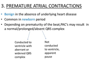 3. PREMATURE ATRIAL CONTRACTIONS
• Benign in the absence of underlying heart disease
• Common in newborn period
• Depending on prematurity of the beat,PAC’s may result in
a normal/prolonged/absent QRS complex
Conducted to
ventricle with
aberrant or
widened QRS
complex
Not
conducted
to ventricle,
apparent
pause
 