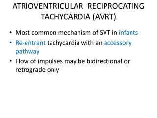 ATRIOVENTRICULAR RECIPROCATING
TACHYCARDIA (AVRT)
• Most common mechanism of SVT in infants
• Re-entrant tachycardia with an accessory
pathway
• Flow of impulses may be bidirectional or
retrograde only
 