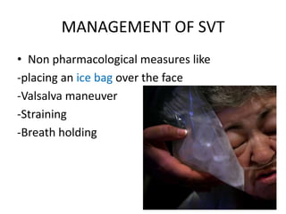 MANAGEMENT OF SVT
• Non pharmacological measures like
-placing an ice bag over the face
-Valsalva maneuver
-Straining
-Breath holding
 