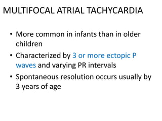 MULTIFOCAL ATRIAL TACHYCARDIA
• More common in infants than in older
children
• Characterized by 3 or more ectopic P
waves and varying PR intervals
• Spontaneous resolution occurs usually by
3 years of age
 