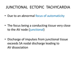JUNCTIONAL ECTOPIC TACHYCARDIA
• Due to an abnormal focus of automaticity
• The focus being a conducting tissue very close
to the AV node (junctional)
• Discharge of impulses from junctional tissue
exceeds SA nodal discharge leading to
AV dissociation
 