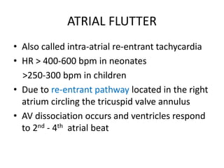 ATRIAL FLUTTER
• Also called intra-atrial re-entrant tachycardia
• HR > 400-600 bpm in neonates
>250-300 bpm in children
• Due to re-entrant pathway located in the right
atrium circling the tricuspid valve annulus
• AV dissociation occurs and ventricles respond
to 2nd - 4th atrial beat
 