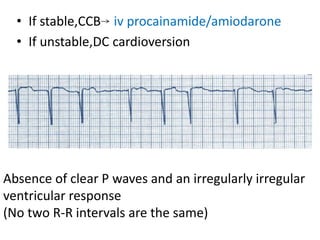 • If stable,CCB iv procainamide/amiodarone
• If unstable,DC cardioversion
Absence of clear P waves and an irregularly irregular
ventricular response
(No two R-R intervals are the same)
 