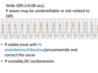 • If stable,treat with IV
amiodarone/lidocaine/procainamide and
correct the cause
• If unstable,DC cardioversion
Wide QRS (>0.08 sec),
P waves may be unidentifiable or not related to
QRS
 