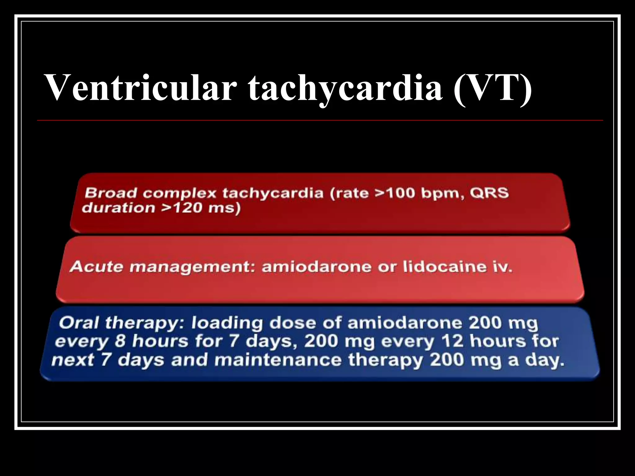 Ventricular tachycardia (VT)
 
