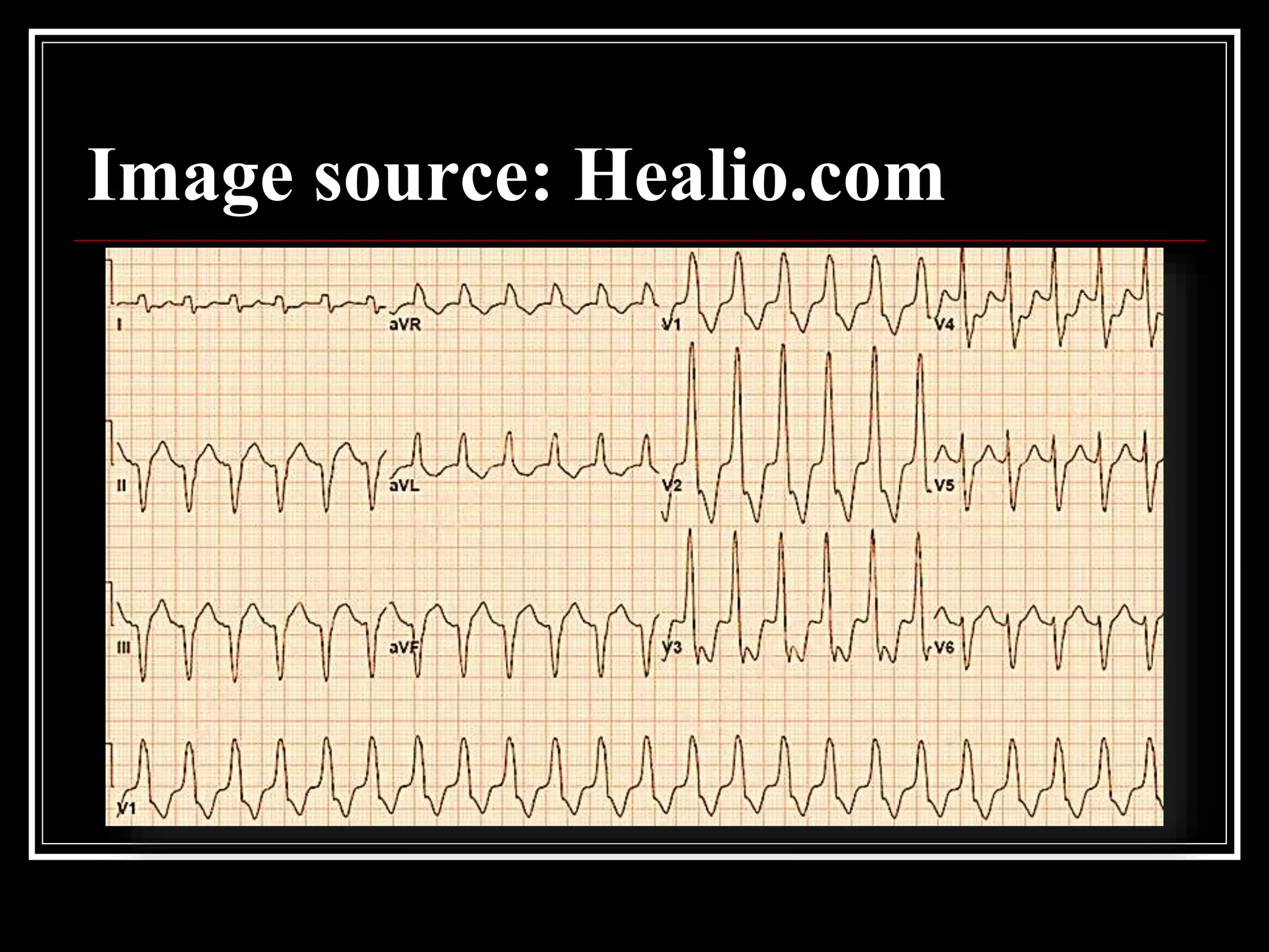 Image source: Healio.com
 