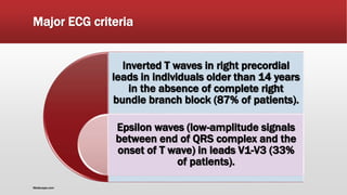 Major ECG criteria
Inverted T waves in right precordial
leads in individuals older than 14 years
in the absence of complete right
bundle branch block (87% of patients).
Epsilon waves (low-amplitude signals
between end of QRS complex and the
onset of T wave) in leads V1-V3 (33%
of patients).
Medscape.com
 