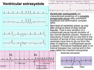 Ventricular extrasystoleVentricular extrasystole
• Ventricular extrasystoleVentricular extrasystole are
characterized presence of a completecomplete
compensate pausecompensate pause after premature
heartbeat and deformation complex
QRS.
• Next beat of ventricles arises up onlyNext beat of ventricles arises up only
after arrival to them of duty normalafter arrival to them of duty normal
impulseimpulse.. That is why duration of a
compensate pause equals duration of
two normal diastolic pauses. However if
reductions of heart are so rare that to the
moment of arrival of duty normal impulse
ventricles have time to go out from the
state of adiphoria, a compensate pause
is absent. Premature heartbeat gets in an
interval between two normal and in this
case called the inserted extrasystole.
 