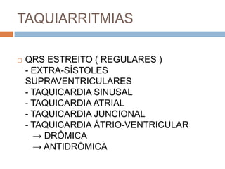 TAQUIARRITMIAS

   QRS ESTREITO ( REGULARES )
    - EXTRA-SÍSTOLES
    SUPRAVENTRICULARES
    - TAQUICARDIA SINUSAL
    - TAQUICARDIA ATRIAL
    - TAQUICARDIA JUNCIONAL
    - TAQUICARDIA ÁTRIO-VENTRICULAR
      → DRÔMICA
      → ANTIDRÔMICA
 