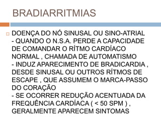 BRADIARRITMIAS
   DOENÇA DO NÓ SINUSAL OU SINO-ATRIAL
    - QUANDO O N.S.A. PERDE A CAPACIDADE
    DE COMANDAR O RÍTMO CARDÍACO
    NORMAL , CHAMADA DE AUTOMATISMO
    - INDUZ APARECIMENTO DE BRADICARDIA ,
    DESDE SINUSAL OU OUTROS RÍTMOS DE
    ESCAPE , QUE ASSUMEM O MARCA-PASSO
    DO CORAÇÃO
    - SE OCORRER REDUÇÃO ACENTUADA DA
    FREQUÊNCIA CARDÍACA ( < 50 SPM ) ,
    GERALMENTE APARECEM SINTOMAS
 