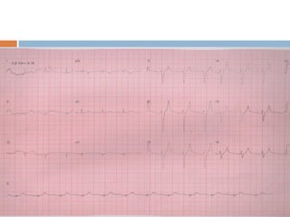    Colocar slides de 5B a 8B
 