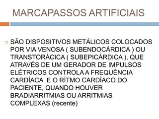 MARCAPASSOS ARTIFICIAIS

   SÃO DISPOSITIVOS METÁLICOS COLOCADOS
    POR VIA VENOSA ( SUBENDOCÁRDICA ) OU
    TRANSTORÁCICA ( SUBEPICÁRDICA ), QUE
    ATRAVÉS DE UM GERADOR DE IMPULSOS
    ELÉTRICOS CONTROLA A FREQUÊNCIA
    CARDÍACA E O RÍTMO CARDÍACO DO
    PACIENTE, QUANDO HOUVER
    BRADIARRITMIAS OU ARRITMIAS
    COMPLEXAS (recente)
 