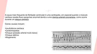A causa mais frequente de fibrilação ventricular é uma cardiopatia, em especial quando o músculo
cardíaco recebe fluxo sanguíneo anormal devido a uma doença arterial coronariana, como ocorre
durante um ataque cardíaco
Outras causas incluem:
•Insuficiência cardíaca
•Cardiomiopatias
•Choque (pressão arterial muito baixa)
•Choque elétrico
•Afogamento
 