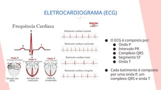 ● O ECG é composto por:
● Onda P
● Intervalo PR
● Complexo QRS
● Segmento ST
● Onda T
● Cada batimento é composto
por uma onda P, um
complexo QRS e onda T
ELETROCARDIOGRAMA (ECG)
 