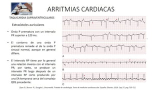 Comprehensive Overview of Cardiac Arrhythmias: Types, Diagnosis, and ...