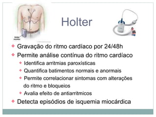 Holter Gravação do ritmo cardíaco por 24/48h Permite análise contínua do ritmo cardíaco Identifica arritmias paroxísticas Quantifica batimentos normais e anormais Permite correlacionar sintomas com alterações do ritmo e bloqueios Avalia efeito de antiarritmicos Detecta episódios de isquemia miocárdica 