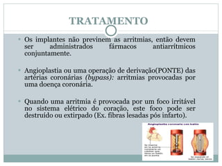 TRATAMENTO Os implantes não previnem as arritmias, então devem ser administrados fármacos antiarrítmicos conjuntamente. Angioplastia ou uma operação de derivação(PONTE) das artérias coronárias  (bypass):  arritmias provocadas por uma doença coronária. Quando uma arritmia é provocada por um foco irritável no sistema elétrico do coração, este foco pode ser destruído ou extirpado (Ex. fibras lesadas pós infarto). 