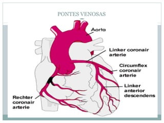 PONTES VENOSAS 