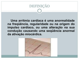 DEFINIÇÃO Uma arritmia cardíaca é uma anormalidade na freqüência, regularidade ou na origem do impulso cardíaco, ou uma alteração na sua condução causando uma seqüência anormal da ativação miocárdica. 