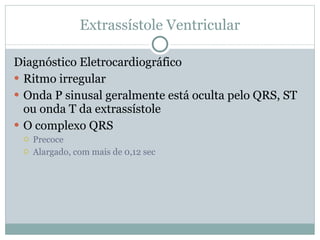 Extrassístole Ventricular Diagnóstico Eletrocardiográfico Ritmo irregular Onda P sinusal geralmente está oculta pelo QRS, ST ou onda T da extrassístole O complexo QRS Precoce Alargado, com mais de 0,12 sec 