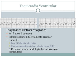 Taquicardia Ventricular Diagnóstico Eletrocardiográfico FC:    100 e    220 spm Ritmo: regular ou discretamente irregular Ondas P : Com FC alta não são vistas Quando presentes não tem relação com o QRS QRS: tem a mesma morfologia das extrassístoles ventriculares 