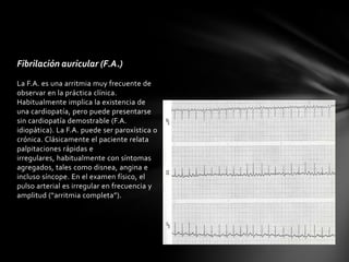 Fibrilación auricular (F.A.)
La F.A. es una arritmia muy frecuente de
observar en la práctica clínica.
Habitualmente implica la existencia de
una cardiopatía, pero puede presentarse
sin cardiopatía demostrable (F.A.
idiopática). La F.A. puede ser paroxística o
crónica. Clásicamente el paciente relata
palpitaciones rápidas e
irregulares, habitualmente con síntomas
agregados, tales como disnea, angina e
incluso síncope. En el examen físico, el
pulso arterial es irregular en frecuencia y
amplitud (“arritmia completa”).
 