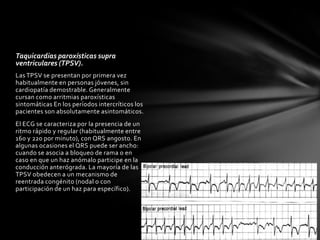 Taquicardias paroxísticas supra
ventriculares (TPSV).
Las TPSV se presentan por primera vez
habitualmente en personas jóvenes, sin
cardiopatía demostrable. Generalmente
cursan como arritmias paroxísticas
sintomáticas En los períodos intercríticos los
pacientes son absolutamente asintomáticos.
El ECG se caracteriza por la presencia de un
ritmo rápido y regular (habitualmente entre
160 y 220 por minuto), con QRS angosto. En
algunas ocasiones el QRS puede ser ancho:
cuando se asocia a bloqueo de rama o en
caso en que un haz anómalo participe en la
conducción anterógrada. La mayoría de las
TPSV obedecen a un mecanismo de
reentrada congénito (nodal o con
participación de un haz para específico).
 