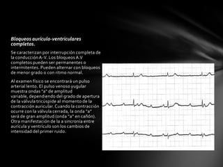 Bloqueos aurículo-ventriculares
completos.
Se caracterizan por interrupción completa de
la conducción A-V. Los bloqueos A.V
completos pueden ser permanentes o
intermitentes. Pueden alternar con bloqueos
de menor grado o con ritmo normal.
Al examen físico se encontrará un pulso
arterial lento. El pulso venoso yugular
muestra ondas "a" de amplitud
variable, dependiendo del grado de apertura
de la válvula tricúspide al momento de la
contracción auricular. Cuando la contracción
ocurre con la válvula cerrada, la onda “a”
será de gran amplitud (onda “a” en cañón).
Otra manifestación de la a sincronía entre
aurícula y ventrículo son los cambios de
intensidad del primer ruido.
 