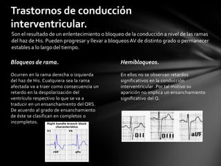 Trastornos de conducción
interventricular.
Son el resultado de un enlentecimiento o bloqueo de la conducción a nivel de las ramas
del haz de His. Pueden progresar y llevar a bloqueos AV de distinto grado o permanecer
estables a lo largo del tiempo.

Bloqueos de rama.                              Hemibloqueos.
Ocurren en la rama derecha o izquierda         En ellos no se observan retardos
del haz de His. Cualquiera sea la rama         significativos en la conducción
afectada va a traer como consecuencia un       interventricular .Por tal motivo su
retardo en la despolarización del              aparición no implica un ensanchamiento
ventrículo respectivo lo que se va a           significativo del Q.
traducir en un ensanchamiento del QRS.
De acuerdo al grado de ensanchamiento
de éste se clasifican en completos o
incompletos.
 