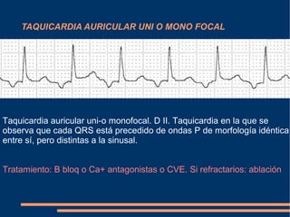TAQUICARDIA AURICULAR UNI O MONO FOCAL Taquicardia auricular uni-o monofocal. D II. Taquicardia en la que se observa que cada QRS está precedido de ondas P   de morfología idéntica entre sí, pero distintas a la sinusal.  Tratamiento: B bloq o Ca+ antagonistas o CVE. Si refractarios: ablación 