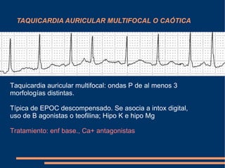 TAQUICARDIA AURICULAR MULTIFOCAL O CAÓTICA Taquicardia auricular multifocal: ondas P de al menos 3 morfologías distintas. Típica de EPOC descompensado. Se asocia a intox digital, uso de B agonistas o teofilina; Hipo K e hipo Mg Tratamiento: enf base., Ca+ antagonistas 