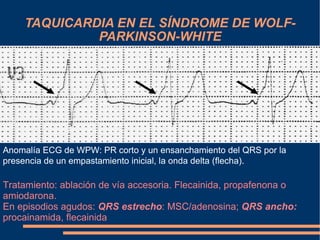 TAQUICARDIA EN EL SÍNDROME DE WOLF-PARKINSON-WHITE Anomalía ECG de WPW: PR corto y un ensanchamiento del QRS por la presencia de un empastamiento inicial, la onda delta (flecha) . Tratamiento: ablación de vía accesoria. Flecainida, propafenona o amiodarona.  En episodios agudos:  QRS estrecho : MSC/adenosina;  QRS ancho:  procainamida, flecainida 