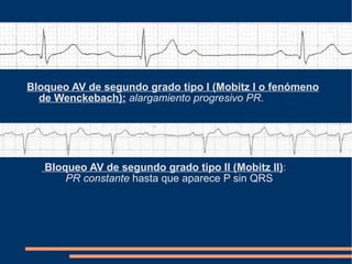 Bloqueo AV de segundo grado tipo I (Mobitz I o fenómeno de Wenckebach):   alargamiento progresivo PR . Bloqueo AV de segundo grado tipo II (Mobitz II) :  PR constante  hasta que aparece P sin QRS 