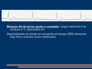 Bloqueo AV de tercer grado o completo : ningún estímulo A se conduce a V: disociación AV. Dependienedo de donde se encuentre el escape QRS estrechos (haz His) o anchos (musc ventricular)   