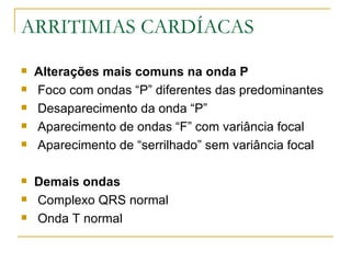 ARRITIMIAS CARDÍACAS
   Alterações mais comuns na onda P
   Foco com ondas “P” diferentes das predominantes
   Desaparecimento da onda “P”
   Aparecimento de ondas “F” com variância focal
   Aparecimento de “serrilhado” sem variância focal

   Demais ondas
   Complexo QRS normal
   Onda T normal
 