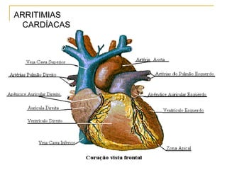 ARRITIMIAS
  CARDÍACAS
 