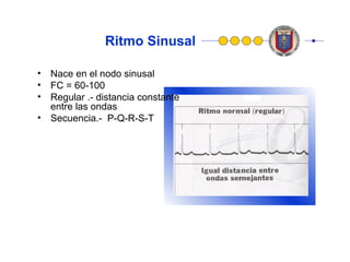 Arritmias | PPT