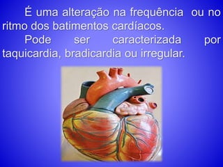É uma alteração na frequência ou no
ritmo dos batimentos cardíacos.
Pode ser caracterizada por
taquicardia, bradicardia ou irregular.
 