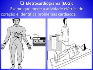  Eletrocardiograma (ECG):
Exame que mede a atividade elétrica do
coração e identifica problemas cardíacos.
 