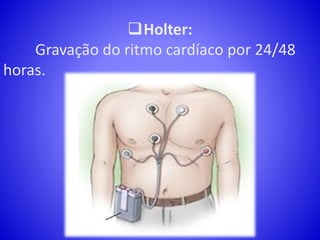 Holter:
Gravação do ritmo cardíaco por 24/48
horas.
 