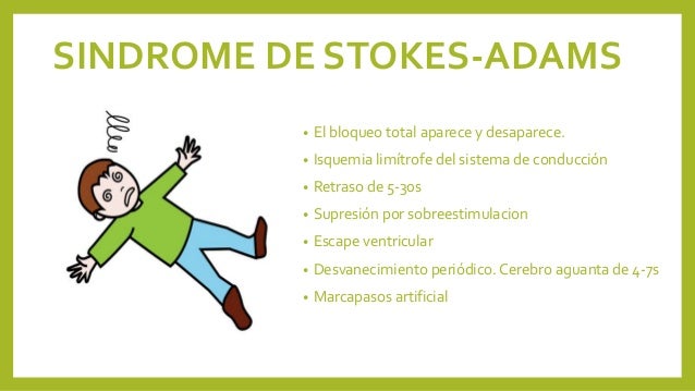 SINDROME DE STOKES ADAMS PDF DOWNLOAD SINDROME DE STOKES ADAMS PDF DOWNLOAD