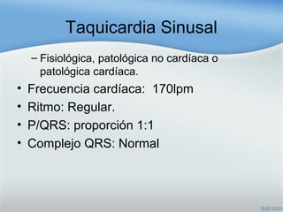 Taquicardia Sinusal
– Fisiológica, patológica no cardíaca o
patológica cardíaca.
• Frecuencia cardíaca: 170lpm
• Ritmo: Regular.
• P/QRS: proporción 1:1
• Complejo QRS: Normal
 