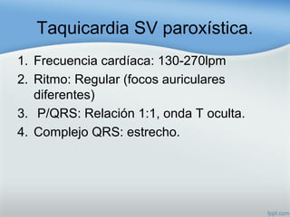 Taquicardia SV paroxística.
1. Frecuencia cardíaca: 130-270lpm
2. Ritmo: Regular (focos auriculares
diferentes)
3. P/QRS: Relación 1:1, onda T oculta.
4. Complejo QRS: estrecho.
 