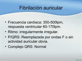 Fibrilación auricular
• Frecuencia cardíaca: 350-500lpm,
respuesta ventricular 60-170lpm.
• Ritmo: irregularmente irregular.
• P/QRS: Reemplazada por ondas F o sin
actividad auricular obvia.
• Complejo QRS: Normal
 