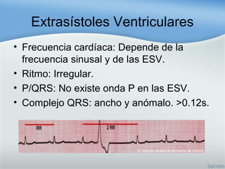Extrasístoles Ventriculares
• Frecuencia cardíaca: Depende de la
frecuencia sinusal y de las ESV.
• Ritmo: Irregular.
• P/QRS: No existe onda P en las ESV.
• Complejo QRS: ancho y anómalo. >0.12s.
 