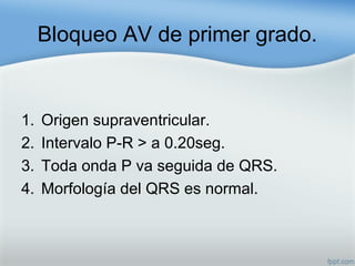 Bloqueo AV de primer grado.
1. Origen supraventricular.
2. Intervalo P-R > a 0.20seg.
3. Toda onda P va seguida de QRS.
4. Morfología del QRS es normal.
 