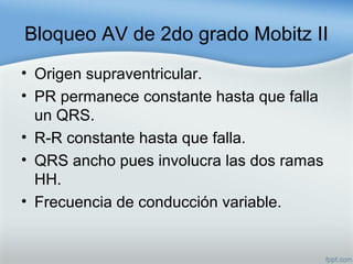Bloqueo AV de 2do grado Mobitz II
• Origen supraventricular.
• PR permanece constante hasta que falla
un QRS.
• R-R constante hasta que falla.
• QRS ancho pues involucra las dos ramas
HH.
• Frecuencia de conducción variable.
 