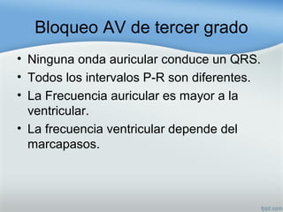 Bloqueo AV de tercer grado
• Ninguna onda auricular conduce un QRS.
• Todos los intervalos P-R son diferentes.
• La Frecuencia auricular es mayor a la
ventricular.
• La frecuencia ventricular depende del
marcapasos.
 